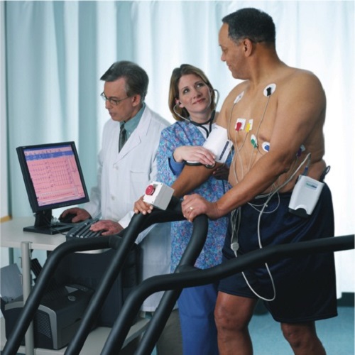 Stress Echocardiography